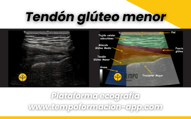 4. Anatomia y ecografia cadera tempo formacion.png
